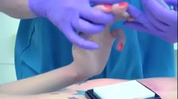 Thumb 7