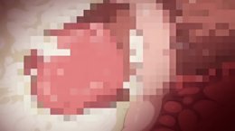 Thumb 10