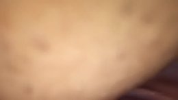 Thumb 12