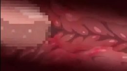 Thumb 8