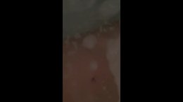 Thumb 6