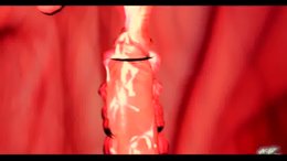 Thumb 13