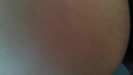 Thumb 9