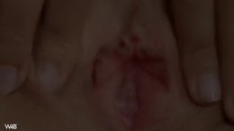 Thumb 13