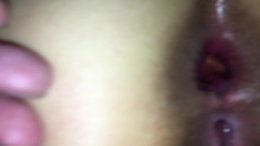 Thumb 15
