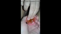 Thumb 9