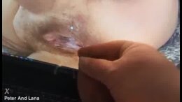 Thumb 15