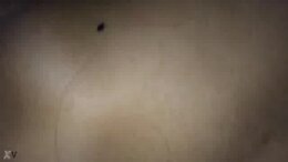 Thumb 8