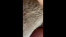 Thumb 8