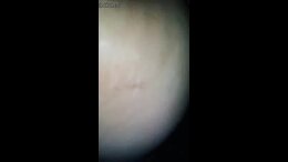 Thumb 15